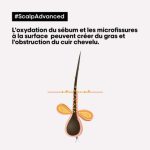 L'OREAL PROFESSIONNEL SCALP ADVANCED SHAMPOOING DERMO PURIFIANT 1500 ML – Image 3